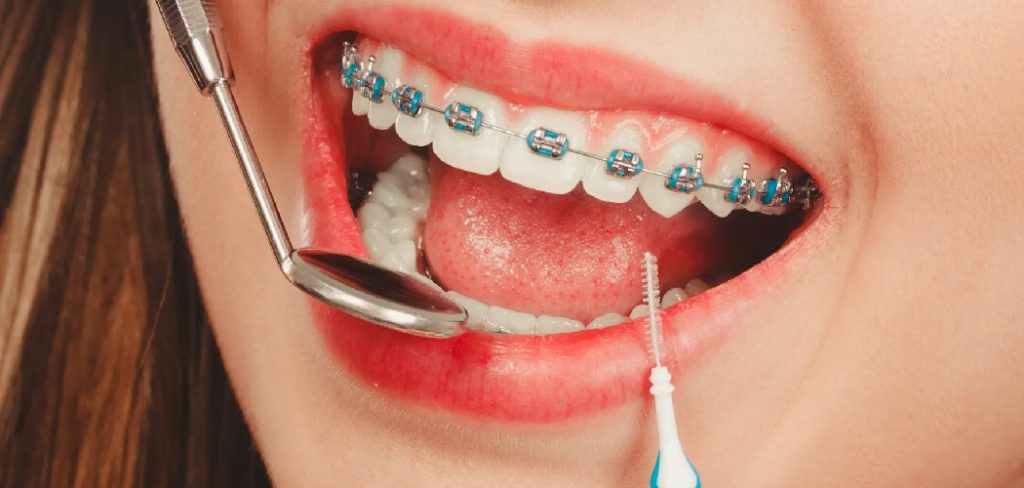 How to Remove Tooth Decay Yourself