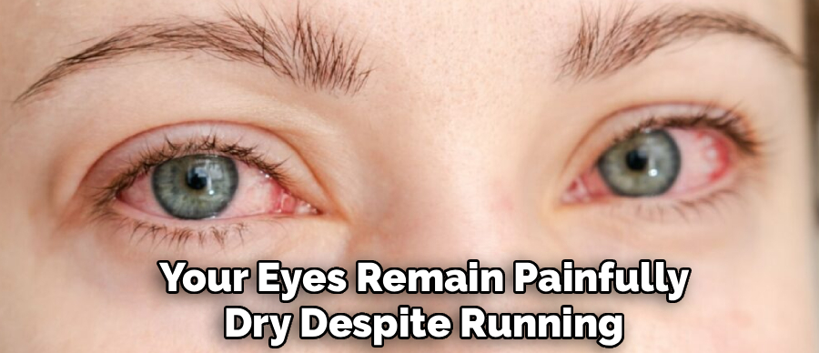 Your Eyes Remain Painfully
Dry Despite Running